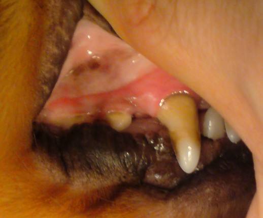 無麻酔歯石除去をする前の歯